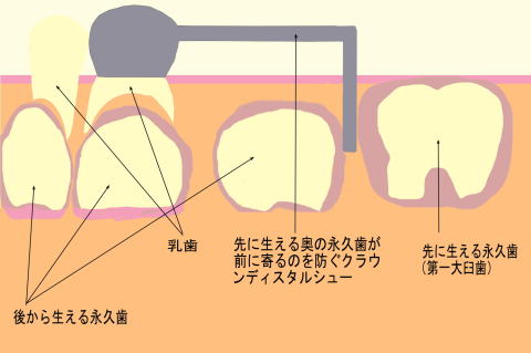 クラウンディスタルシュー